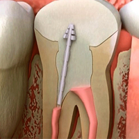 best dental clinic in bangalore